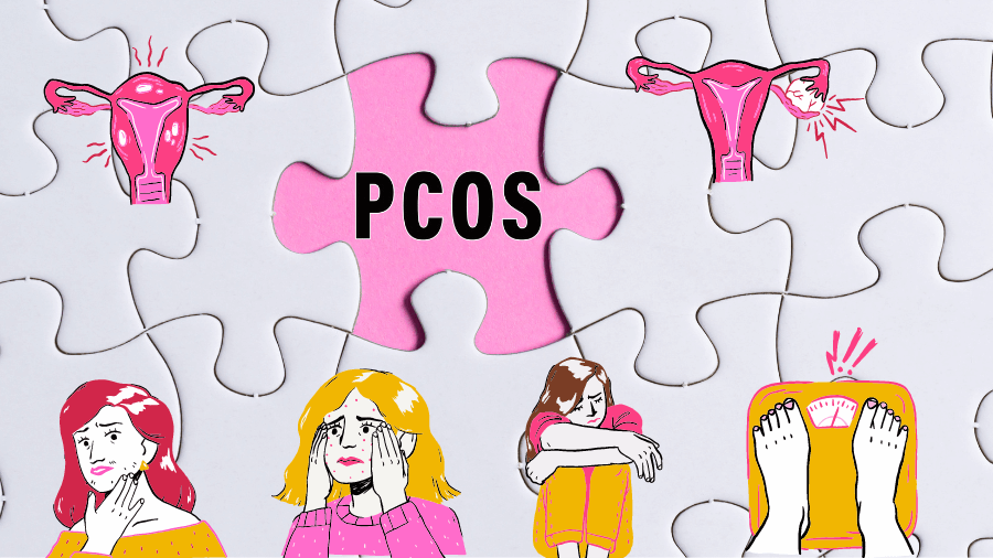 Top 10 natural home remedies for PCOS treatment
